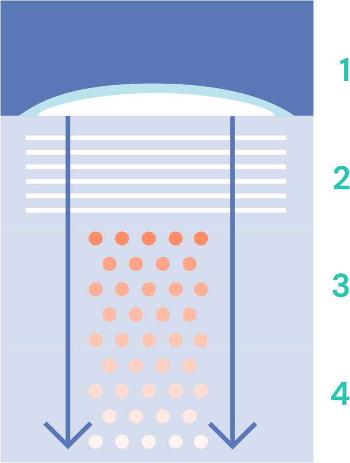 how emla numbling works