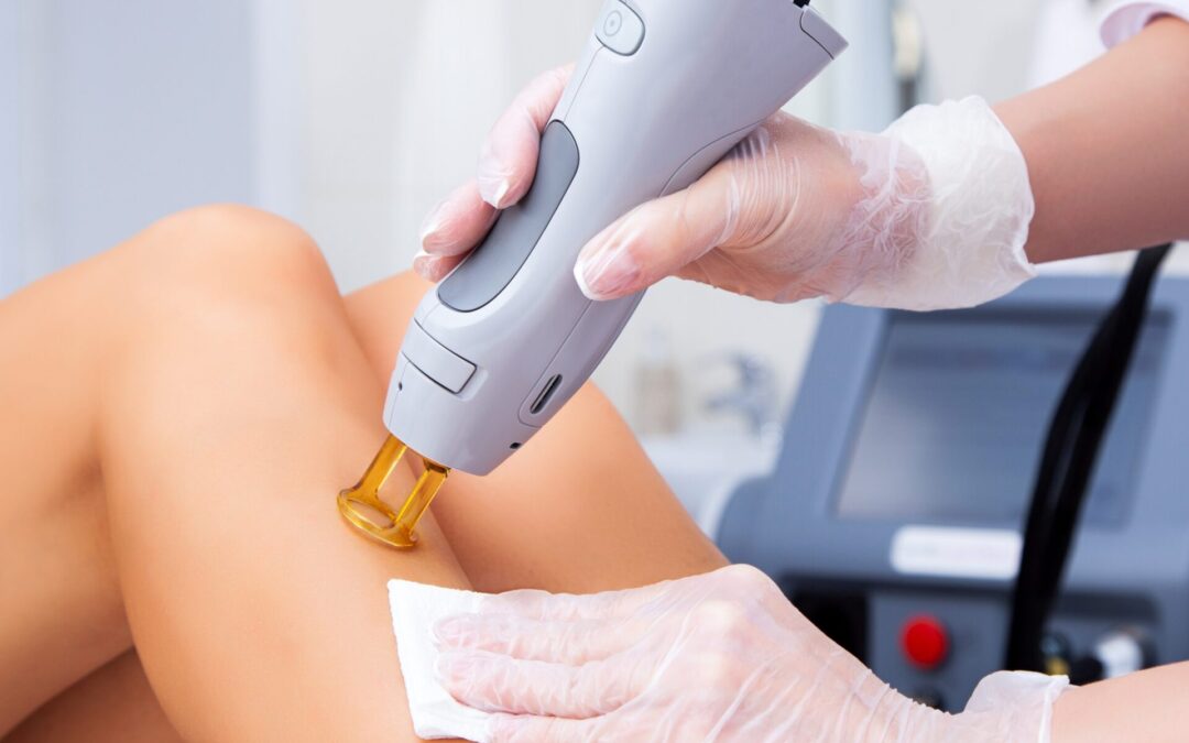 Ready, Set, Go Bare: 7 Tips for a More Comfortable Laser Hair Removal